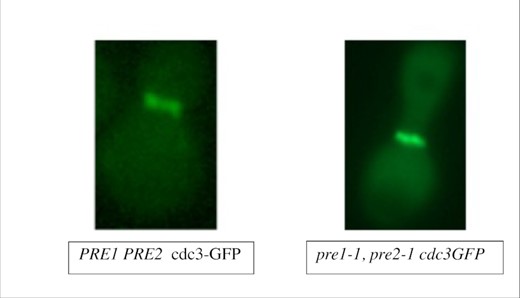 A GFP-tagged septin/Cdc3 localizes normally to a ring at the mother-bud neck in proteasome-mutant yeast cells expressing C99. Wild-type or proteasome-deficient yeast cells were transformed with a plasmid for expression of GFP-tagged septin (CDC3-GFP; Richman et al. 1999). Micrographs of log-phase cells were captured to examine CDC3-GFP localization to the ring in the mother-bud neck. Scale bar corresponds to 5 µm.