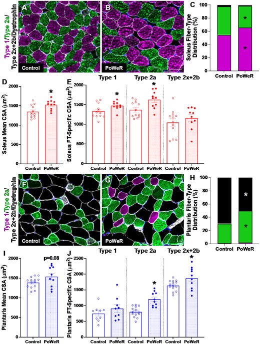 Changes in muscle fiber type and size following PoWeR. Representative images of Type 1 (pink), Type 2a (green), Type 2x + 2b (black) and dystrophin (white) immunohistochemistry (IHC) in the soleus from (A) control and (B) PoWeR trained old mice. (C) Soleus fiber-type distribution. (D) Soleus mean fiber CSA. (E) Soleus fiber-type specific (Type 1, Type 2a, and Type 2x + 2b) CSA. Representative images of Type 1 (pink), Type 2a (green), Type 2x + 2b (black) and dystrophin (white) IHC in the plantaris from (F) control and (G) PoWeR trained old mice. (H) Plantaris fiber-type distribution. (I) Plantaris mean fiber CSA. (J) Plantaris fiber-type specific (Type 1, Type 2a, and Type 2x + 2b) CSA. CSA = cross-sectional area. Open bars = control mice, dotted bars = PoWeR mice. * indicates P < 0.05. Scale bars = 50 μm. Error bars represent SEM. N = 10–14 per group.