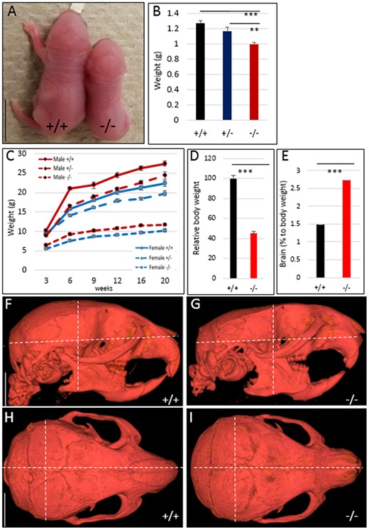 Comparison of body size and growth curves for Hmga2+/+, Hmga2+/−, and Hmga2−/− mice. (A) Comparison of representative littermates of wild-type and knock-out at day 1. Scale bar = 5 mm. (B) Average body weight for each genotype on day 1, n ≥ 5. (C) Growth curves of male and female mice from 3 to 20 weeks of age. n = 18/22 Hmga2+/+, 41/58 Hmga2+/−, and 24/18 Hmga2−/− (female/male). (D and E) Comparison of body weight and brain weights between genotypes at 14 weeks of age. Relative weight loss was determined by dividing gross mass by a control littermate weight, n = 4. (F–I) MicroCT analysis for wild-type and knock-out individuals along the sagittal plane (F and G) and frontal plane (H and I). Dotted white lines indicate landmark measurements for length, width, and height that are significantly offset in Hmga2−/− animals. Scale bar = 5 mm.