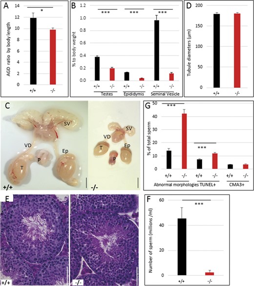 Significant impairment of male reproductive organs in Hmga2tamu-ko mice. (A) AGD corrected for body length. (B) Relative reduction of reproductive organs. (C) Representative images of the genital track of Hmga2+/+ (left) and Hmga2−/− (right) male mice at 14 weeks of age. Scale bar = 5 mm. (D) Tubule diameters were determined in Hmga2+/+ and Hmga2−/− male mice. (E) Representative hematoxylin and eosin-stained sections of testis from Hmga2+/+ (left) and Hmga2−/− (right) mice. Scale bar = 50 μm. (F) Total epididymal sperm counts from 14 weeks old males (n = 6). (G) Percent of sperms with abnormal morphologies, DNA damage (TUNEL+) and CMA3-stained cells from wild-type and knock-out mouse testes. Ep, epididymis; P, penis; SV, seminal vesicle; T, testis; VD, vas deferens.