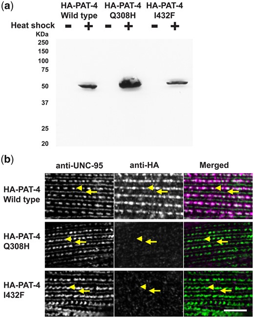 PAT-4 Q308H and PAT-4 I432F mutant proteins that cannot bind to UNC-112 do not localize to integrin adhesion complexes. a) Western blot of lysates from transgenic nematodes carrying HA-tagged PAT-4 wild type, Q308H or I432F, expressed from a heat shock promoter, with heat shock (+) or without heat shock (−), reacted with anti-HA. Note that the apparently different level of expression of HA-PAT-4 is due to the variable rate of transmission of these extrachromosomal arrays in the different transgenic lines. b) Localization of heat shock-expressed HA-tagged PAT-4 wild type, Q308H, and I432F in transgenic animals. Worms were immunostained with anti-HA to detect the transgenic PAT-4 and with anti-UNC-95 to visualize the optical plane in body wall muscle cells that contain the integrin adhesion complexes (dense bodies and M-lines). Wild-type HA-PAT-4 localizes normally to dense bodies and M-lines. However, Q308H and I432F HA-PAT-4 fail to localize to these structures. Arrows indicate M-lines, and arrowheads indicate dense bodies. White bar, 10 μm.