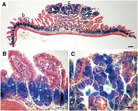 β-GAL expression in normal and adenomatous tissue in the small intestine. Tumor-bearing small intestine of a R11 homozygous B6 ApcMin/+ mouse was stained with X-GAL to reveal β-GAL activity, as described in Materials and Methods. Lower (A) and higher (B-C) magnifications reveal β-GAL staining of the lower proliferative zone in the normal intestinal crypt (B) and the adenoma (C). Scale bar = 50 μm.