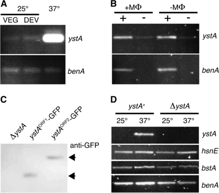 Expression from the 1E11 region in P. marneffei. (A) RT-PCR using P. marneffei RNA extracted from vegetative hyphal cells growing at 25° for 2 d (VEG), cells undergoing asexual development at 25° after 7 d (DEV), and yeast cells growing at 37° for 2 d using ystA-specific primers. Primers for the β-tubulin–encoding benA gene were used as a control. (B) RT-PCR using P. marneffei RNA extracted from yeast cells growing in J774 mouse macrophages (+MΦ) or in macrophage cell culture medium (−MΦ) for 24 hr using ystA-specific primers. To assess the amount of contaminating genomic DNA in the samples, both reverse-transcriptase (+) and no reverse-transcriptase (−) reactions were performed; benA was used as a control. (C) Western blot analysis using total cell extracts from P. marneffei yeast cells of the ystA deletion strain (ΔystA) and strains containing either the ystA ORF1 or the ORF2 GFP fusions. Cells were grown at 37° for 2 d and then extracts were fractionated on an SDS-PAGE gel, blotted, and Western blotted with a polyclonal anti-GFP primary antibody and an anti-rabbit HRP secondary antibody. Polyclonal anti-β-tubulin was used as a control. (D) RT-PCR expression analysis of ystA and the flanking hsnE and bstA genes in the wild-type and ystA deletion strain using RNA extracted from vegetative hyphal cells growing at 25° for 2 d or yeast cells growing at 37° for 2 d.