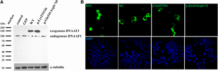 Protein expression and location of wild-type (WT) and mutant DNAAF1. (A) Expression of GFP-tagged DNAAF1 protein is shown by a Western blot analysis of whole cell lysate with anti-DNAAF1. α-tubulin was used as a loading control. Protein expression level of DNAAF1 c.691A > C was almost identical with the wild type, while DNAAF1 c.1022_1023delAA could hardly be detected. (B) Immunofluorescence staining showing protein location. Both c.691A > C mutant and wild-type GFP-tagged DNAAF1 protein localized in the cytoplasm, whereas no green immunofluorescence was detected in c.1022_1023delAA mutant transfected HEK293T cells. Transfected cells are marked by GFP (green).