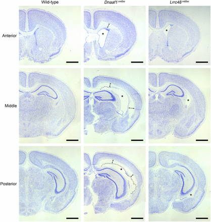 Hydrocephalus phenotype. Nissl-stained images of coronal sections are shown. Enlarged lateral ventricles are marked with asterisks. Enlargement of the third ventricles is also evident in both mutants. Dotted lines in Dnaaf1m4Bei mutant images indicate disruption in ependymal lining. Double-headed arrows indicate transependymal edema. Scale bars, 1 mm.