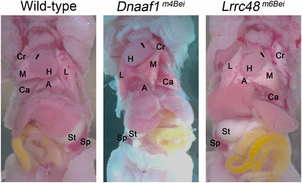 Situs inversus phenotype. The position of the heart (H), lung lobes (L, Cr, M, Ca, and A), stomach (St), and spleen (Sp) shows a laterality defect. Arrows indicate the angle of pulmonary trunk. A, accessary lobe; Ca, right caudal lobe; Cr, right cranial lobe; L, left lobe; M, right middle lobe. 