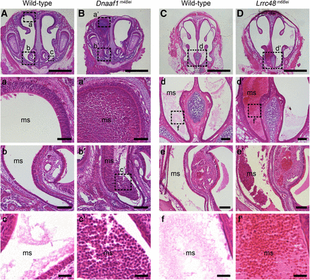 Mucus accumulation in the sinuses. (A–D) Coronal sections of the maxillary sinuses (ms) from mutant and littermate wild-type mice are stained using hematoxylin and eosin. Higher magnification images of the boxed region (a–f for wild-type and a’–f’ for mutants) are shown in lower panels. e and e’ are from more posterior paranasal cavity sections. Severe mucus accumulation and infiltration of neutrophils (c’) were obvious in a Dnaaf1m4Bei mutant at P7. Lrrc48m6Bei mutants show milder phenotype that is undetectable until later (16 week-old). Scale bars: A–D, 1 mm; a, a’, b, b’, d’, e, and e’, 100 μm; c, c’, f, and f’, 25 μm.