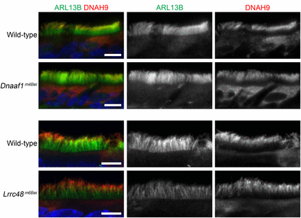 Normal localization of DNAH9 in the mutants. Anti-ARL13B (green, middle) and anti-DNAH9 (red, right) coimmunostaining was performed. DNAH9 is distally localized in the ciliary axoneme of the motile cilia in the upper airway. The nuclei were stained using Hoechst (blue). Scale bars, 5 μm.