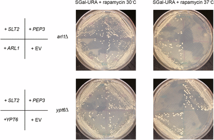 SLT2 and PEP3 suppress the rapamycin sensitivity at 37° of the arl1Δ or ypt6Δ strains, respectively. SGal-URA (galactose‐ containing medium without uracil) containing 5 ng/ml rapamycin was used in this assay. The images are taken on day 10 of growth. 