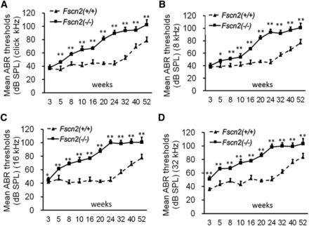 Observation of the auditory-evoked brainstem response thresholds in Fscn2−/− mice. Auditory-evoked brainstem response (ABR) thresholds tested in Fscn2−/− and Fscn2+/+ mice at 10 time points from 3 to 52 weeks of age. (A) Measured at click stimulus frequency. (B) Measured at 8 kHz stimulus frequency. (C) Measured at 16 kHz stimulus frequency. (D) Measured at 32 kHz stimulus frequency. There were 7 to 10 mice in each Fscn2−/− group and 6 to 10 mice in each Fscn2+/+ group at each time point. Error bars represent the standard error of the mean. * P < 0.05; ** P < 0.01