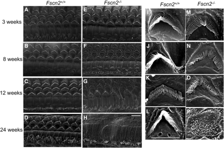 Alterations of stereocilia in the basal turns of cochleae in Fscn2−/− mice. Alterations of stereocilia of Fscn2−/− mice observed using scanning electron microscopy. Fscn2+/+ mice showed normal appearance of stereocilia in OHCs in the basal turns of cochleae. (A) Image taken at age 3 weeks. (B) Image taken at age 8 weeks. (C) Image taken at age 12 weeks. (D) Image taken at age 24 weeks. However, stereocilia in the Fscn2−/− mice were abnormal. (E) Irregular stereocilia at age 3 weeks. (F) Disrupted stereocilia at age 8 weeks. (G) Disrupted stereocilia at age 12 weeks. (H) Completely lost stereocilia at age 24 weeks. Impairment in stereocilia of the inner hair cells was also remarkable in Fscn2−/− mice (E-H). The bundles of stereocilia in Fscn2+/+ mice showed normal morphology at ages 3, 8, 12, and 24 weeks (i-I). However, those of stereocilia in Fscn2−/− mice were shorter in lengths and weaker in stiffness at age 3 weeks (M), became collapse at ages 8 and 12 weeks(N, O) and were completely lost at age 24 weeks (P), compared with those in Fscn2+/+ mice. Scale bars = 5 μm.