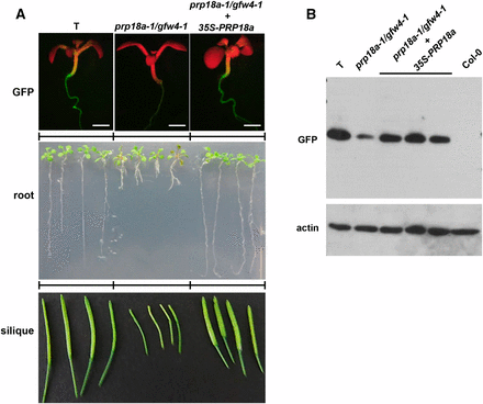 Phenotypic analysis of the prp18a-1/gfw4-1 mutant and complemented line. A. GFP fluorescence in seedlings (top), root growth of seedlings on solid MS medium (middle) and developing siliques (bottom) of the wild-type T line, the prp18-a-1/gfw4-1 mutant and the prp18a-1/gfw4/1 mutant complemented with a PRP18a transgene under the control of the 35S promoter. B. Western blot analysis of GFP protein in the wild-type T line, prp18a-1/gfw4-1 mutant and three complemented lines. Non-transgenic Col-0 is shown as a negative control. The top panel was probed with an antibody to GFP protein. The bottom panel shows the same blot re-probed with an antibody to actin as a loading control.
