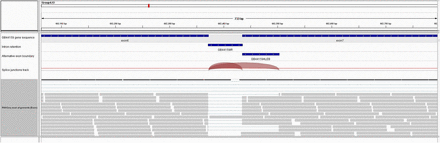 Alternatively spliced transcripts identified in A. melifera for the Dscam gene. Aligned reads are shown here in IGV genome browser (Thorvaldsdóttir et al. 2013). First track provides a zoomed in view of GB44159 (Dscam) gene in the honeybee (Amel 4.5) genome between exon 6 and 7 that has the AS event. Track 2 and 3 indicate the region corresponding to intron retention event and alternative left exon boundary respectively. Track 4 shows the splice junction spanning the AS events. Track 5 shows RNA-seq reads in honeybee brain mapped to this region.