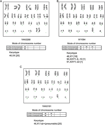 Karyotype analysis. The karyotypes of the three cell lines YAN3268 (A), WY084 (B), and YAN3191 (C) were analyzed. A representative karyotype of the sample of 20 cells karyotyped and 50 mode-analyzed cells. The chromosome notation system follows the guidelines in ISCN (An International System for Human Cytogenetic Nomenclature) 1991.
