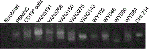 V(D)J recombination. PCR products were separated on a gel and the amplified V(D)J recombination products are shown. Fibroblasts were used as a recombination-negative control. PBMNCs and CD19+ cells (B-lineage cells) were used as multiclonal recombination-positive controls. If the cell line is monoclonal, then a single band is generated by PCR.