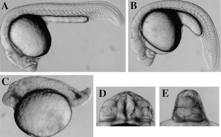 Wild-type (A, D) cycb213 (B, E) and necb213 (C) diploid embryos at 22 hours after fertilization. Side (A–C) and frontal (D, E) views are shown.
