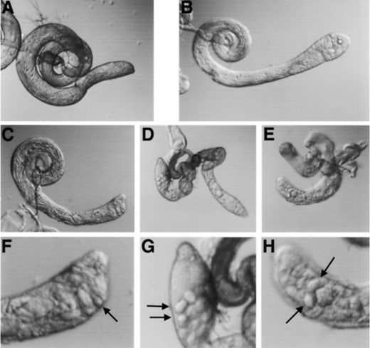 Testis morphology in mei-P26 mutants as visualized by DIC microscopy. (A) Wild-type testis. (B) mei-P261/y+Y testis contains highly refractile degenerating cysts (arrow). (C) mei-P26mfs1/y+Y testes support the production of elongated spermatid bundles, but not motile spermatids. (D) No elongated spermatids are present in testes from bamΔ86 homozygotes. (E) Spermatid differentiation also fails to progress in mei-P261/y+Y; bamΔ86/+ testes (note morphological similarity to D). (F) Magnified view of anterior tip of the mei-P26mfs1/y+Y testes from C (above). Arrow, degenerating cyst. (G) Magnified view of anterior tip of the bamΔ86 homozygote testes from D (above). Arrows, degenerating cysts. (H) Magnified view of anterior tip of the mei-P261/y+Y; bamΔ86/+ testes from E (above). Arrows, degenerating cysts.