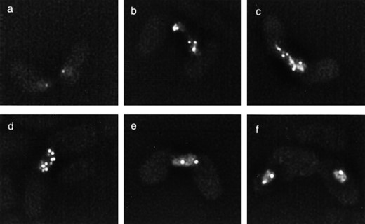 —Localization of Rec7-GFP in zygotic meiosis. Living homothallic cells of strain SA16 undergoing mating and meiosis were observed at different stages by fluorescence microscopy. (a) Early karyogamy. (b) Karyogamy. (c) Typical horsetail nucleus. (d) Nucleus at end of horsetail movements. (e) Nucleus at meiosis I. (f) Nucleus at meiosis II. For further explanation see the text.