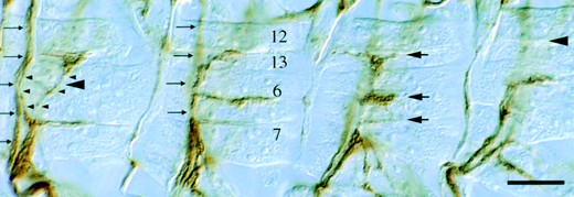—ISNb defects typical of Ptp69D mutants. Four adjacent ISNb nerves from a Ptp69D20 embryo are shown. The center ISNbs display wild-type morphology. The large arrows indicate clefts between muscles 12, 13, 7, and 6, sites at which the ISNb normally synapses. The right ISNb prematurely terminates at the proximal edge of muscle 13 and so lacks the distalmost synapse between muscles 13 and 12 (large arrowhead). The left ISNb displays a partial bypass defect in which axons that normally would innervate muscle 13 instead rejoin the ISN nerve, indicated by small arrows (out of focus in the other hemisegments). The two branches of the split ISNb are indicated by small arrowheads. Bar, ∼10 μm.
