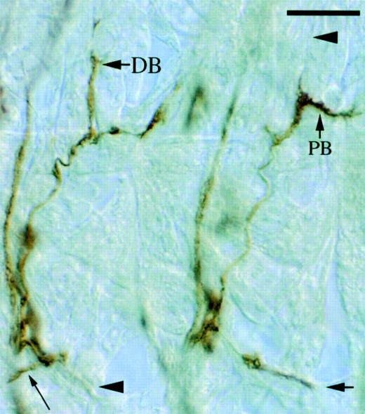 —SNc defects typical of Ptp69D mutants. Two adjacent SNc nerves from a Ptp69D22 embryo are shown. The right SNc displays normal morphology, growing posterio-medially (large arrow). The left SNa branches normally but then turns anterio-medially (small arrow). The bifurcation of the SNa dorsal branch is indicated (DB). Note that the right SNa fails to form a dorsal branch (arrowhead) and that the posterior branch (PB) is thick, suggesting the presence of ectopic dorsal branch axons. Bar, ∼10 μm.