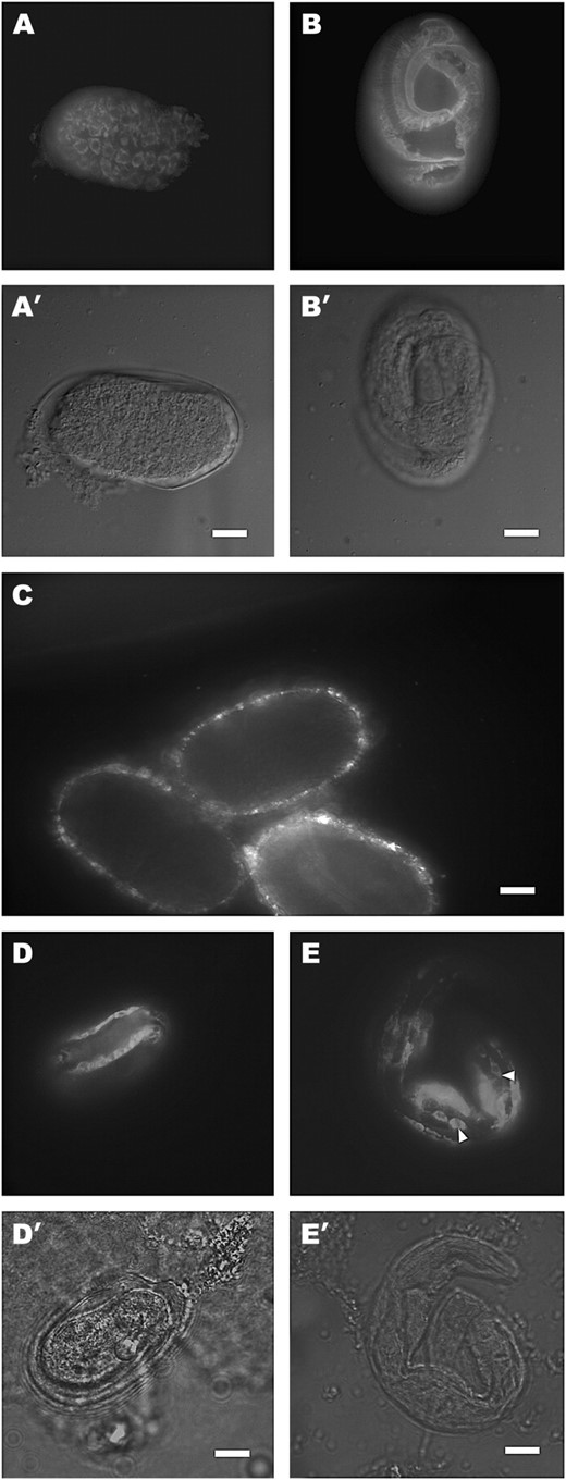 IF staining experiments of N2 worms and sqt-3(e2924, e2117) mutants with the R584 SQT-3-specific serum. (A and B) IF Staining of N2 embryos with the R584 serum. A′ and B′ are the differential interference contrast (DIC) micrographs of A and B. In comma-stage embryos (A), the reactive antigen is detected intracellularly in a perinuclear distribution. By the late threefold stage (B), all antigen is assembled into the cuticle. (C) e2924 embryos labeled with the R584 serum. No specific signal is detected. The puncta represent background fluorescence. (D and E) Staining of e2117 embryos with the R584 serum. D′ and E′ are the DIC micrographs of D and E. The animals in D and E were raised at 15° and at 25°, respectively. In both cases, SQT-3 failed to be secreted. The animal in D is a threefold-stage embryo, while the one in E is an arrested L1 larva. Note the persistence of the retained collagens in the hypodermis of the L1 specimen (E, arrowheads). Bars, 10 μm.