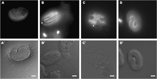 IF staining of unsuppressed and suppressed dpy-31 mutants with the R584 serum. (A) e2770 comma-stage embryo raised at 20°, showing an apparently normal pattern of intracellular staining. (B) e2770 threefold-stage embryo raised at 20°. In comparison to wild type (Figure 5B), annular staining is aberrant. Gaps lacking SQT-3 are visible (arrowhead); moreover, the signal appears generally blurred, indicating that the antigen could diffuse within the cuticle. (C) e2770 threefold-stage embryo raised at 25°. Disruption of SQT-3 localization is enhanced. Areas of intense fluorescence are visualized (arrowhead), which may represent aggregates of misassembled SQT-3 molecules. (D) e2770; e2902 threefold-stage embryo raised at 25°. SQT-3 assembly is restored to wild type. Bars, 10 μm.