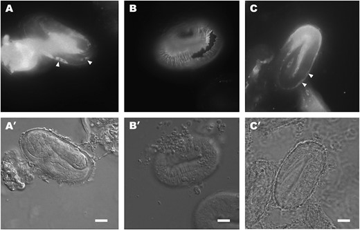 IF staining of sqt-3(sup) cs-lethal mutants with the R584 serum. (A) e2909 threefold-stage embryo reared at 15°. Note the presence of retained collagen forms in some hypodermal cells (arrowheads). (B) e2909 threefold-stage embryo reared at 25°. SQT-3 is assembled normally into the cuticle. (C) e2908 threefold-stage embryo reared at 15°. The arrowheads indicate intracellularly retained SQT-3. Bars, 10 μm.