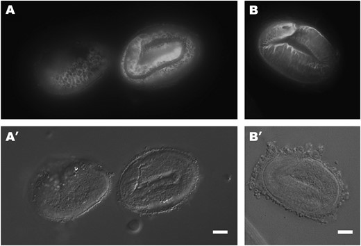 IF staining of dpy-17(−) and dpy-17(sup) dpy-31(−) mutants with the R584 serum. (A) e164 comma-stage embryo (left) and threefold-stage embryo (right) raised at 25°. While the comma-stage pattern appears normal, SQT-3 is retained intracellularly in thethreefold-stage embryo. (B) dpy-17(e2899) dpy-31(e2770) threefold-stage embryo raised at 25°. SQT-3 extracellular assembly is restored to wild type. Bars, 10 μm.
