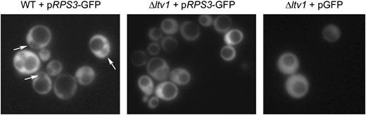 RpS3-GFP export is retarded in Δltv1 cells. Wild-type (WT) (LY134) and Δltv1 (LY136) cells transformed with either pRPS3-GFP (Ld50) or pGFP (pUG23) were grown in media lacking histidine and methionine to early log phase, harvested, and visualized by fluorescence microscopy as described in materials  and  methods. Arrows identify the nuclear-excluded phenotype scored in Table 3.