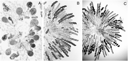 Rosettes of asci showing the consequences of the meiotic silencing of actin and the suppression of silencing by Sad-1Δ and Sk-2. (A) ∷act+ × wild type 6 days after fertiliztion. Abnormally swollen asci resulting from silencing of actin genes. Karyogamy is normal in the swollen asci but almost all asci abort and degenerate without completing meiosis I. (B) ∷act+ × Sad-1Δ 8 days after fertilization. Meiosis and postmeiotic mitoses are completely normal; the silencing of actin is suppressed by Sad-1Δ. (C) ∷act+ × Sk-2 8 days after fertilization. As in the case of Sad-1Δ, the meiotic silencing of actin is suppressed by Sk-2. The 4:4 ascospore patterns result from the death of the Sk-sensitive ascospores. The consequence of the suppression of MSUD by Sk-2 is identical to that of Sad-1Δ, except that there is no ascospore death in the Sad-1Δ cross. Sk-3 also suppresses the MSUD of actin but to a lesser degree than with Sk-2.