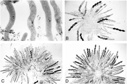 Abnormal ascus development resulting from the meiotic silencing of Bml and mei-3 genes and the suppression of silencing by Sk-2. (A) ∷BmlR × wild type 5 days after fertilization. The β-tubulin genes are silenced, and ascus development is arrested prior to metaphase I. (B) ∷BmlR × Sk-2 8 days after fertilization. Meiotic silencing of β-tubulin is suppressed by Sk-2, and asci continue to develop through ascospore maturation. The maturing asci show Sk-caused 4:4 ascospore abortion patterns. (C) ∷mei-3+ × wild type 8 days after fertilization. A rosette of mostly aborted asci; <5–10% of asci contain mature ascospores. Nuclear divisions do occur in the aborted asci, albeit abnormally, and most of the asci delimit eight ascospores, which become vacuolated and degenerate. (D) ∷mei-3+ × Sk-2 7 days after fertilization. Meiotic silencing is completely suppressed by Sk-2, and the ascus development through spore delimitation is normal. The maturing asci show 4:4 patterns for Sk.