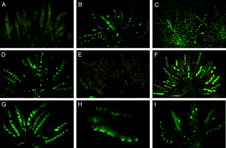 The use of GFP-tagged hH1 and β-tubulin genes for visualizing meiotic silencing and its suppression by Sad-2RIP, Sk-2, and Sk-3. (A) Wild type × ∷hH1-GFP 4 days after fertilization. In the heterozygous asci, the unpaired hH1-GFP is completely silenced in young asci throughout meiosis, a postmeiotic mitosis, and spore delimitation. (B) Sad-2RIP × ∷hH1-GFP 5–6 days after fertilization. Meiotic silencing of hH1-GFP is suppressed by Sad-2RIP, and the nuclei fluoresce throughout meiosis, a postmeiotic mitosis, and in the young ascospores. As the ascospores develop, the nuclear hH1-GFP fluorescence gradually fades away in four of the eight non-hH1-GFP ascospores. (C) ∷hH1-GFP (female) × Sk-2 (male) 5–6 days after fertilization. Meiotic silencing of hH1-GFP is suppressed by Sk-2, and the nuclei fluoresce throughout meiosis and in the young ascospores. The background fluorescent nuclei are in the nonascogenous paraphyseal cells of the female parent. (D) Sk-3 × ∷hH1-GFP 6 days after fertilization. Meiotic silencing of hH1-GFP is suppressed by Sk-3, just as in Sad-2RIP × ∷hH1-GFP (6B). (E–H) Meiotic silencing of β-tubulin and its suppression by Sad-1Δ, Sk-2, and Sk-3. (E) Wild type × ∷Bml-GFP 6 days after fertilization. The expression of β-tubulin is silenced, and the asci are arrested early in meiosis. (F) Sad-1Δ × ∷Bml-GFP 8 days after fertilization. Meiotic silencing of β-tubulin is suppressed by Sad-1Δ. Developing asci and four of the eight ascospores of each ascus show β-tubulin–GFP. (G) Sk-2 × ∷Bml-GFP 6 days after fertilization. Meiotic silencing of β-tubulin is suppressed by Sk-2, resulting in normal ascus and ascospore delimitation. The far right ascus shows a bright spindle in each ascospore at the first mitosis. Sk-caused death of four of the eight ascospores is just visible in two asci. (H) Sk-3 × ∷Bml-GFP 5 days after fertilization. Meiotic silencing of β-tubulin is suppressed by Sk-3. Two asci at spore delimitation (top and bottom) show fluorescent spindle pole bodies at one end of each young ascospore. (I) Sk-2 × Sk-2;∷hH1-GFP 5 days after fertilization. Meiotic silencing of hH1-GFP is suppressed by Sk-2 even when Sk-2 is homozygous, and there is no ascospore killing. Thus suppression of MSUD is independent of ascospore killing. (A and B are from Shiu  et al. 2006.)