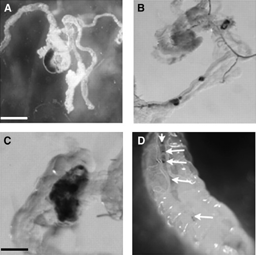 Naturally forming melanotic tumors from third instar hybrid males. These tumors form primarily in gut tissue (A–C), although they also develop in salivary glands (not shown). Bar, 100 μm for A and B; 250 μm for C. (D) Lower magnification of several gut tumors in a single larvae.
