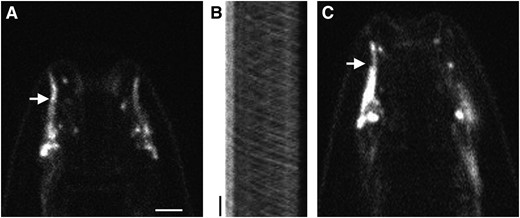 DYF-11 may associate with IFT particle B. (A) Localization of DYF-11∷GFP in the cilia (arrow) of a wild-type animal. (B) Kymograph of the cilia seen in A, showing anterograde and retrograde movement of DYF-11∷GFP. Position is displayed on the horizontal axis and time on the vertical axis. The transition zone of the cilium is on the left. Vertical bar, 5 sec. (C) DYF-11∷GFP can enter the distal segment of cilia in a bbs-8(nx77) mutant animal (arrow). Bar, A–C, 2.5 μm.