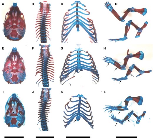 Phenotype of skeleton in late-term PatDp(dist7)T9H-0/Tg fetuses. (A–D) Wild type. (E–H) PatDp(dist7)T9H-Igf2+/−, 0/Tg. (I–L) Cdkn1c−/+. (A, E, and I) Skull, ventral surface. (B, F, and J) Spine. (C, G, and K) Ribcage. (D, H, and L) Forelimb (top); hindlimb (bottom). Bone, stained red; cartilage, stained blue. Prominent features, as indicated by arrows, include cleft palate (I), smaller ossification centers in vertebrae (F and J), bifurcated sternum (G and K), shorter bone length in forelimbs and hindlimbs and hypo-ossification in phalanges (H and L). Bars, 0.5 cm.