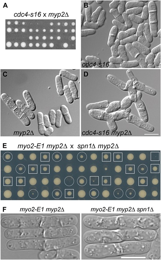 Genetic interactions among AMR and septin mutations. (A–D) Synthetic lethality between cdc4-s16 and myp2Δ. (A) Strains JW400 (cdc4-s16) and TP5 (myp2Δ) were crossed, and tetrads were dissected and incubated on YE5S medium at 32° for 6 days. Nine tetrads were tetratypes (i.e., contained one wild-type spore, two single-mutant spores, and one inviable or very slow-growing double-mutant spore) and one was a parental ditype (i.e., each spore was a single mutant and thus grew well). (B–D) DIC micrographs of aberrant cytokinesis in strains JW400, TP5, and JW345 (cdc4-s16 myp2Δ). Cells were grown overnight in YE5S liquid medium at 30°. Bar (B–D), 10 μm. (E and F) Absence of synthetic interaction between myo2-E1 myp2Δ and spn1Δ. (E) Strains TP90 (myo2-E1 myp2Δ) and JW380 (myp2Δ spn1Δ) were crossed, and tetrads were dissected and incubated on a YE5S plate at 25° for 7 days. Circles, myo2-E1 myp2Δ segregants; squares, myo2-E1 myp2Δ spn1Δ segregants. (F) Cells of strains TP90 and JW2560 were grown exponentially in YE5S liquid medium at 25°, shifted to 36° for 4 hr, and examined. Bar, 10 μm.
