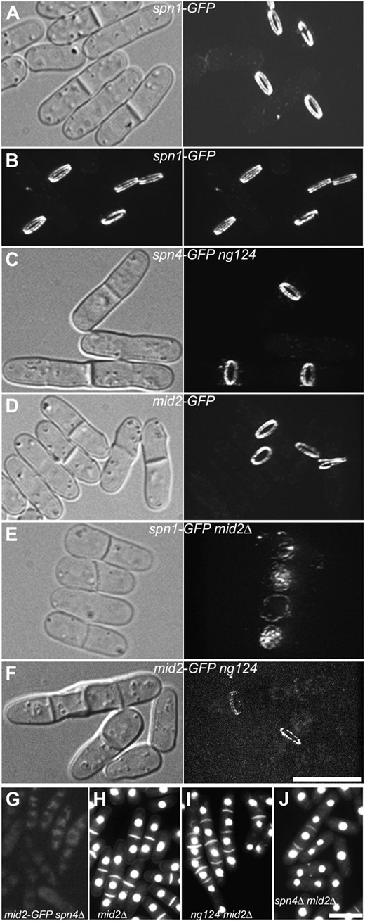 Functional relationships among the septins, Mid2, and Scw1. Cells were observed by spinning-disk confocal microscopy (A–F) or by wide-field fluorescence microscopy (G–J) after growth in YE5S at 25° (A–G) or EMM5S at 30° (H–J). In each case, the cells shown are representative of large numbers of cells examined. For the fluorescence images in A–F, stacks of 70 z-sections (0.07-μm) were captured using the same laser power and acquisition settings and projected into three-dimensional images using Image J (see materials and methods). Selected views of the three-dimensional images are shown with corresponding DIC images; the entire series can be viewed in File S5, File S6, File S7, File S8, and File S9. (A and B) Localization of Spn1-GFP in wild-type strain JW306. The images in B are a stereo pair. (C) Localization of Spn4-GFP in scw1-ng124 strain JW320. (D) Localization of Mid2-GFP in wild-type strain JW326. (E) Localization of Spn1-GFP in mid2Δ strain JW318. (F) Localization of Mid2-GFP in scw1-ng124 strain JW1203. (G) Localization of Mid2-GFP in spn4Δ strain JW332. (H–J) Mutant phenotypes of strains (H) JW430 (mid2Δ), (I) JW315 (scw1-ng124 mid2Δ), and (J) JW314 (spn4Δ mid2Δ). Cells were stained with bisbenzimide to view nuclei and septa. Bars, 10 μm.