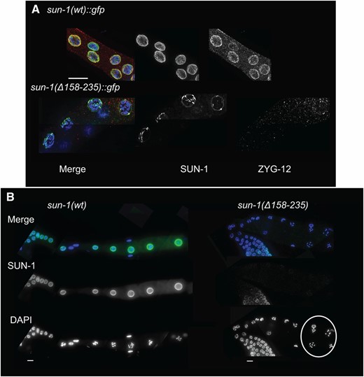 SUN-1 loss is most prominent at late stages of prophase I. (A) DAPI (blue), SUN-1 (green), and ZYG-12 (red) staining of diplotene nuclei in the wild type and Psun-1(Δ158–235) II; sun-1(ok1282) V mutant. Note the prominent loss of both SUN-1 and ZYG-12 in the later stages of meiosis in the mutant (32 out of 40 mutant nuclei had no ZYG-12 signal and 8 displayed barely detectable signal). (B) Loss of SUN-1 leads to misalignment of the oocytes. DAPI (blue) and SUN-1 (green) staining in wild-type and mutant germ lines. The white circle shows disruption of the wild-type alignment of oocytes in the absence of SUN-1 in the nuclear rim (misalignment in 10 out of 15 gonads in the mutant, in 0 out of 10 in wild type). Bar, 10 µm.