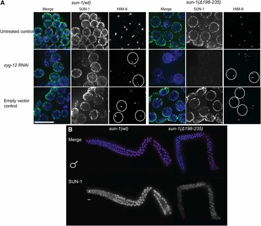 SUN-1 cc regions counterbalance forces on the SUN-KASH bridge. (A) Midpachytene nuclei of sun-1(wt) and Psun-1(Δ158–235) II; sun-1(ok1282) V gonads 48 hr post-L4. DAPI (blue), SUN-1(green), and HIM-8 (red) costainings of gonads either treated with zyg-12 RNAi, untreated, or treated with empty vector control. White circles delineate the unpaired X chromosomes in case of RNAi treatment and the paired X chromosomes when treated with empty vector. Note the severe destruction of the gonad architecture in the absence of both SUN-1 and ZYG-12 in the mutant. (B) Costaining of DAPI (blue) and SUN-1 (red) in L4 gonads (undergoing spermatogenesis) of wild type and Psun-1(Δ158–235) II; sun-1(ok1282) V. Note the absence of the severe SUN-1 loss in the L4 gonads in the later stages of prophase I in the mutant. Bar, 10 µm.