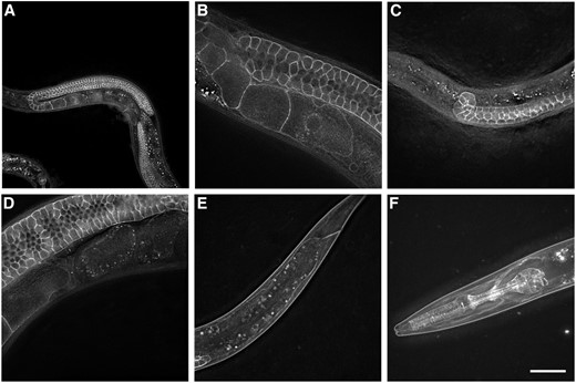 pitr-1 is strongly expressed in C. elegans germline. Expression of endogenous PITR-1::GFP is indicated in (A and B) germline of young adults; (C) germline of larvae; (D) quickly degrading in embryos; (E) body-wall muscles of larvae; and (F) pharynx, head muscles, and muscle arms. Bar, 20 μm.