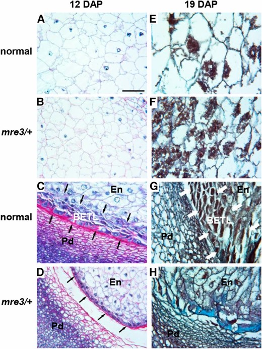 Endosperm defects in mre3. (A–D) Longitudinal sections of 12 DAP kernels stained with Schiff’s reagent and aniline blue-black. Insoluble carbohydrates in cell walls and starch grains stain fuschia; nucleoli, nuclei, and cytoplasm stain different intensities of blue. (E–H) Longitudinal sections of 19 DAP kernels stained with safranin and Fast Green. Starch and secondary cell walls are intensely stained. All samples were collected during the fall season. (A and E) Central endosperm of normal sibling kernels. (B and F) Central endosperm of mre3 kernels. (C and G) BETL endosperm region of normal kernels. (D and H) BETL endosperm region of mre3 kernels. Arrows indicate BETL. Bar, 0.1 mm (shown in A) applies to all panels. En, inner endosperm; Pd, pedicel.
