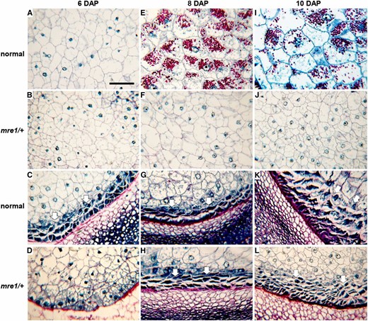 Endosperm development defects in mre1. Longitudinal sections through 6 DAP (A–D), 8 DAP (E–H), and 10 DAP (I–L) kernels sampled during the spring field season. All sections were stained with Schiff’s reagent and aniline blue-black. Insoluble carbohydrates in cell walls and starch grains stain fuschia; nucleoli, nuclei, and cytoplasm stain different intensities of blue. (A, E, and I) Central endosperm of normal sibling kernels. (B, F, and J) Central endosperm of mre1 kernels. (C, G, and K) BETL endosperm region of normal kernels. (D, H, and L) BETL endosperm region of mre1 kernels. Arrows indicate BETL. Bar, 0.1 mm (shown in A) applies to all panels.