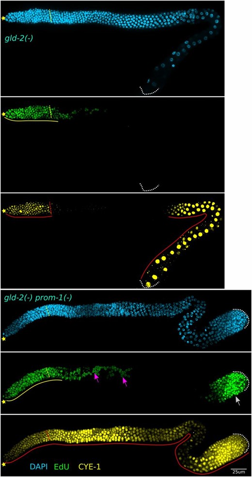 SCFPROM-1 loss of function in combination with gld-2 null results in synthetic overproliferation. Images of dissected germlines from young-adult gld-2 (top) and gld-2 prom-1 (bottom) mutant hermaphrodites, labeled with EdU for 4 hr (green), and costained for CYE-1 (yellow) and DAPI (cyan). ☆ indicates distal gonadal end. Dashed yellow (top) or red (bottom) lines indicate position of overt meiotic entry. Solid yellow lines indicate continuous EdU zone. Solid red lines indicate continuous CYE-1 accumulation. White arrow indicates proximal proliferation; pink arrow indicates stray EdU+ cells proximal to progenitor zone. Dotted white lines indicates proximal end of the germlines.