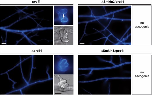 Septation of the vegetative mycelium and ascogonial coils in pro11 and Δpro11 single mutants, as well as in ΔSmkin3/pro11 and ΔSmkin3Δpro11 double mutants. Arrow indicates septum in the ascogonial coil. Mycelium samples were grown on complete solid malt–cornmeal fructification medium for 2 days and stained with Calcofluor White M2R. Bars: white represent 20 μm and black represent 10 μm.