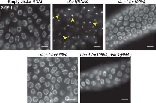 DLC-1 but not other dynein complex components are required for CE protein loading. Animals were raised at 25°C for 24 h before gonads were dissected, and whole mount fixed and probed with anti-SYP-1. All RNAi-treated animals were N2 animals raised on RNAi from larval stage L1. Images show early pachytene region of ovary. Top left: WT N2 gonad treated with empty vector control RNAi for comparison. Top middle: dlc-1(RNAi) animals display foci of SYP-1 in each nucleus (arrowheads), while both temperature sensitive mutants of dhc-1(or195ts)(top right) and dnc-1(or676ts) (bottom left) display normal synapsis. RNAi knockdown of dnc-1 in a dhc-1(or195ts) mutants yields normal synapsis of chromosomes (bottom right). Meiotic progression is depicted from left to right. Scale bars 5 μm.