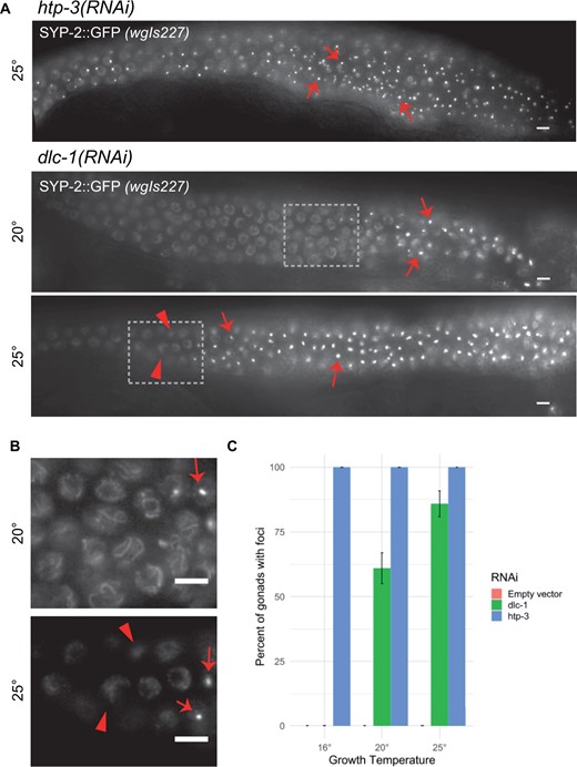 Synapsis defect in dlc-1(RNAi) is temperature sensitive. (A) Live GFP visualization of SYP-2::EGFP in wgIs227; syp-2(ok307) V animals raised on dlc-1 or htp-3 dsRNA from larval stage L1, and analyzed at 48 h post-larval L4 stage. htp-3(RNAi) animals always display SYP-2::GFP foci. dlc-1(RNAi) animals raised at both temperatures display foci of SYP-2::GFP (arrows). Boxed portions of (A) shown at higher magnification in (B). Unaffected nuclei display normal SYP-2 loading in dlc-1(RNAi) at 20°C, but show less structured localization in dlc-1(RNAi) at 25°C in nuclei preceding foci formation (arrowheads). (C) Percentage of gonads with extended regions of SYP foci in dlc-1(RNAi) animals. The SYP foci phenotype is not temperature sensitive in htp-3(RNAi) animals in which 100% of gonads display the phenotype at all temperatures assayed (n > 60 total gonads scored at each temperature). Animals fed empty vector control never displayed the SYP foci phenotype at any of the three temperatures measured (n > 60 total gonads scored at each temperature). Meiotic progression displayed from left to right in all images. Scale bars 5 μm.