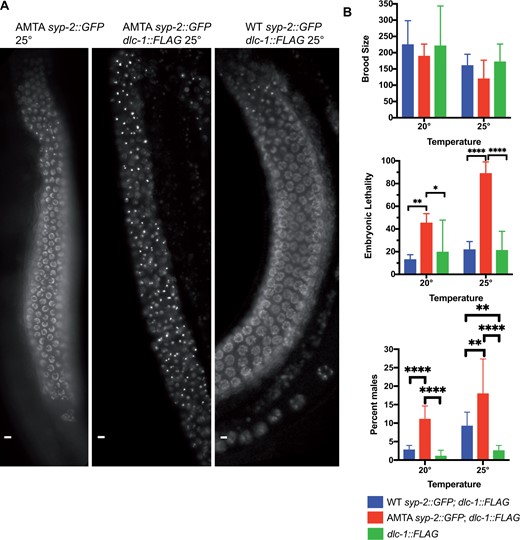 DLC-1::FLAG transgene enhances AMTA mutant defects. (A) Live imaging of GFP in AMTA syp-2::gfp, WT syp-2::gfp; dlc-1::flag, and AMTA syp-2::gfp; dlc-1::flag animals grown at 25°C. Flag tagging DLC-1 in the AMTA strain results in SYP aggregates seen in dlc-1(RNAi) animals. (B) 8–15 WT syp-2::gfp; dlc-1::flag, AMTA syp-2::gfp; dlc-1::flag, and dlc-1::flag animals were singled out for each temperature and progeny stats were recorded until each worm stopped laying embryos similar to Figure  5. The addition of the dlc-1::flag transgene increased embryonic lethality of the WT syp-2::gfp animals to 12.81% at 20°C and 21.5% at 25°C, while increasing embryonic lethality of AMTA syp-2::gfp animals to 44.98% at 20°C and to 88.66% at 25°C. ANOVA followed by Tukey’s post hoc test was used for statistical analysis. *P ≤ 0.05, **P ≤ 0.01, ***P ≤ 0.001, ****P ≤ 0.0001.