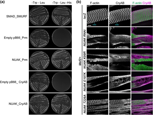 CryAB physically interacts with NUAK and accumulates abnormally in NUAK mutant muscles. a) Y2H experiments test for an interaction between bait and prey proteins. Yeast growth on media lacking Trp and Leu verify the presence of the bait and prey plasmids. Colony growth on selective media plates (–Trp –Leu –His) indicates a physical interaction between SMAD_SMURF (positive control), NUAK_Prm, and NUAK_CryAB. No growth was observed for the empty bait vector with Prm or CryAB. Three independently transformed yeast clones were tested for each bait-prey pair. b) L3 larval muscles stained with phalloidin to visualize F-actin or an antibody raised against CryAB. F-actin and CryAB overlap at the Z-disc and can be observed in complementary patterns in control Mef2 > lacZ muscles. Muscle expression of NUAK RNAi or NUAK kinase domain mutations (K99R, E197K, or T226A) all show abnormal accumulation of CryAB in regions that lack F-actin. Scale bar, 50 µm.