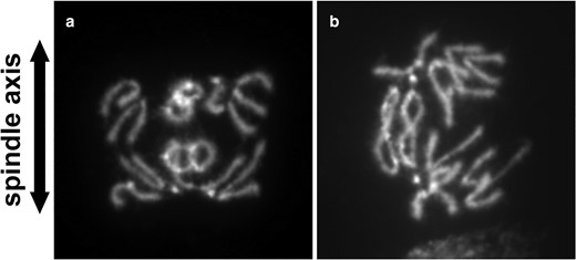 Anaphase figures from R(1;Y) homozygotes. Divisions showing: a) catenation of nonsister chromatids; or b) catenation of sister chromatids.