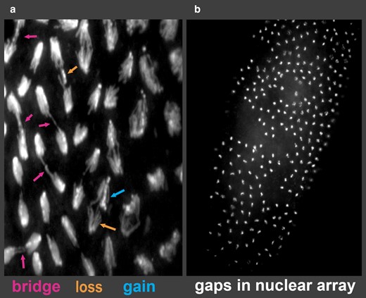 Embryonic phenotypes of R(1;Y) embryos. a) Embryonic mitoses showing anaphase bridges of varying types and chromosome loss and gain events. b) Typical blastoderm embryo showing large regions lacking nuclei.